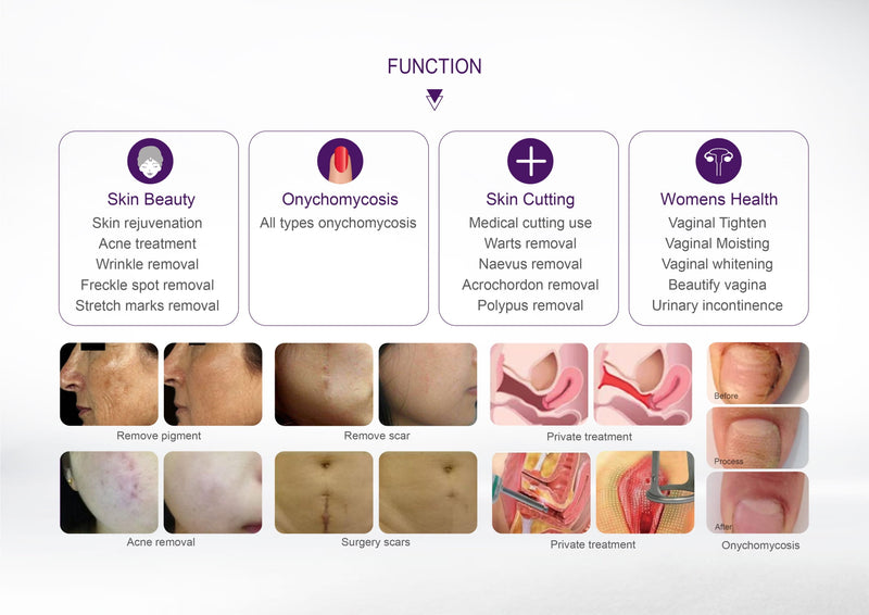 Profesionalus CO2 Frakcinis Lazeris 10600 nm su Ginekologiniu Antgaliu, Premium klasės modelis